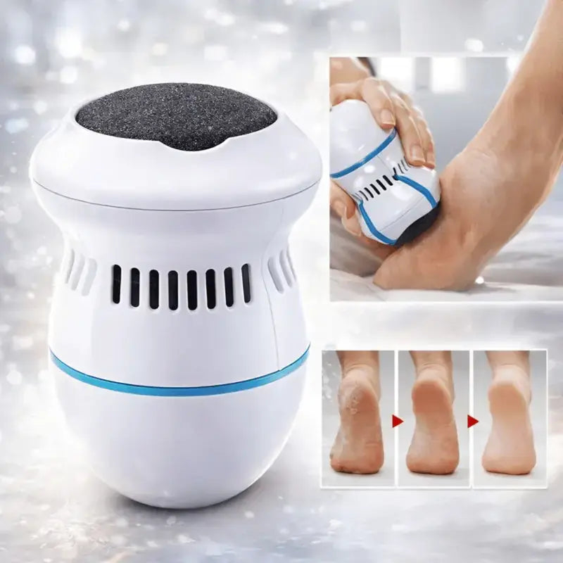 DoucePieds – Râpe Électrique Aspirante